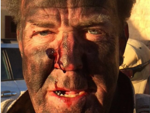 Jeremy Clarkson nach dem Stunt